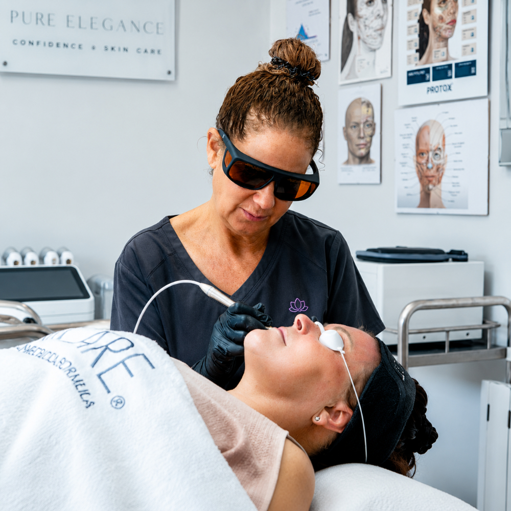 3D Vasculase Laser Thread Vein Removal