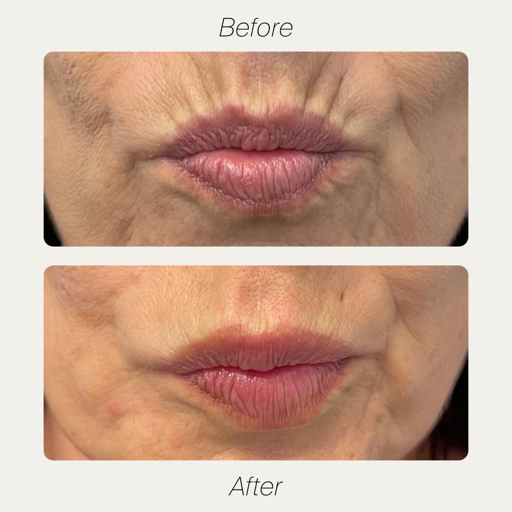 Christina maintenance treatment before and after comparison one
