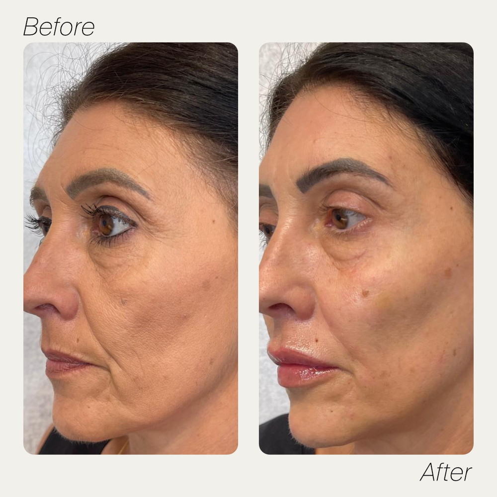 Christina maintenance treatment before and after comparison two