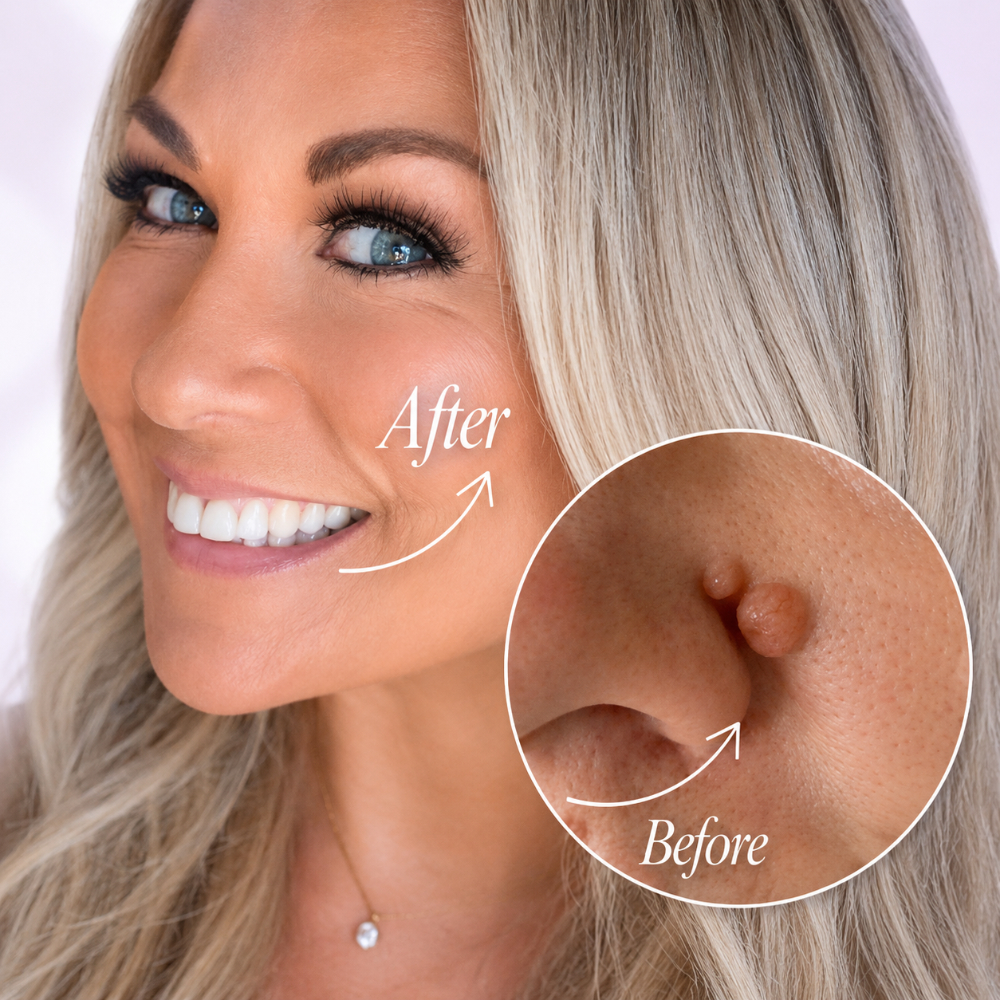 Non-surgical corrections